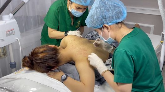 Đặc Trị Viêm Nang Lông - Royal CLinic Thành Phố Hồ Chí Minh
