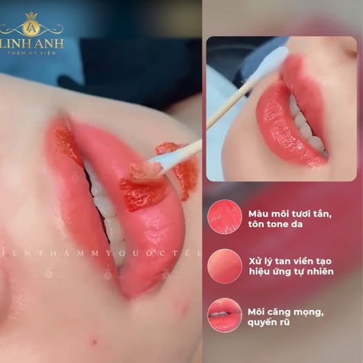 Linh Anh - Trung Tâm Làm Đẹp Uy Tín Sài Gòn