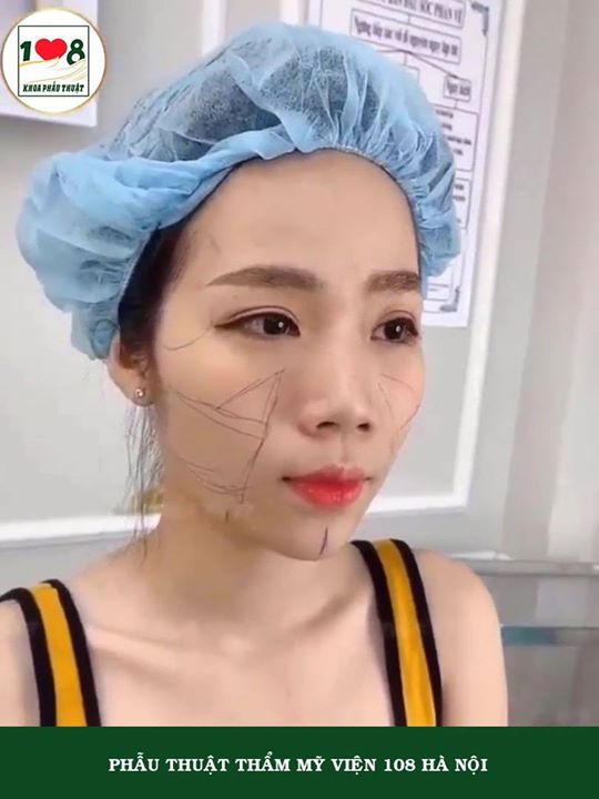 Khoa Phẫu Thuật Thẩm Mỹ - Bệnh Viện 108 Hà Nội.