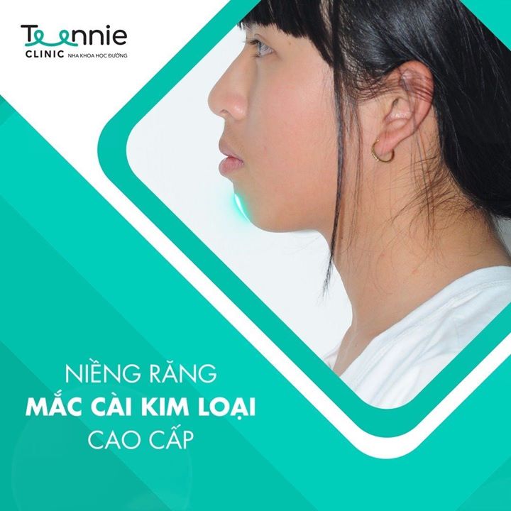 Teennie - Nha Khoa Học Đường