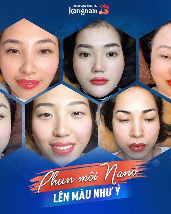 Bệnh viện thẩm mỹ Kangnam