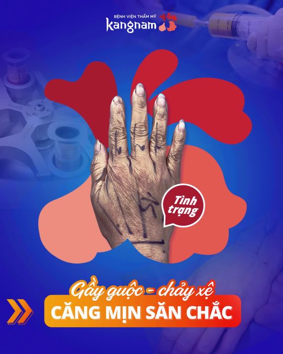 Trẻ Hóa Da - BVTM Kangnam