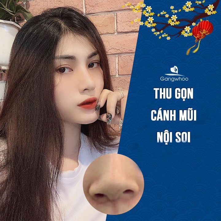 Thẩm Mỹ Viện Gangwhoo