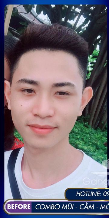 Thẩm Mỹ Viện Gangwhoo