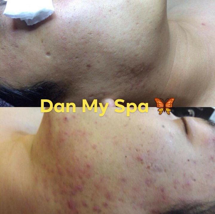 Viện Thẩm Mỹ Dan My Kbeauty- Bắc Ninh