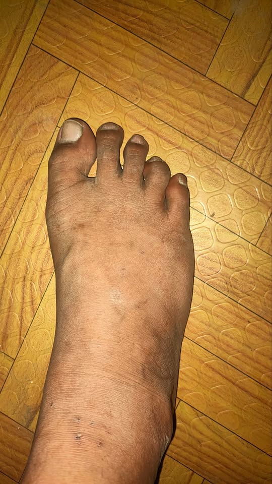 The Gout and Arthritis Community