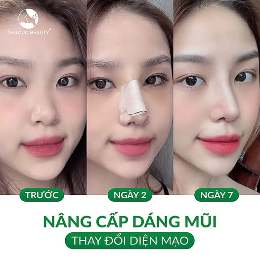 Bệnh Viện Thẩm Mỹ Thu Cúc TP HCM