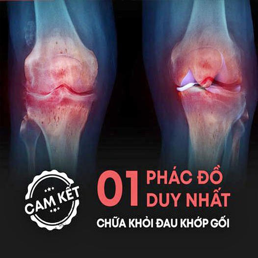 Điều Trị Chuyên Khoa Cơ Xương Khớp Quốc Tế Việt Đức - Quận 1 HCM