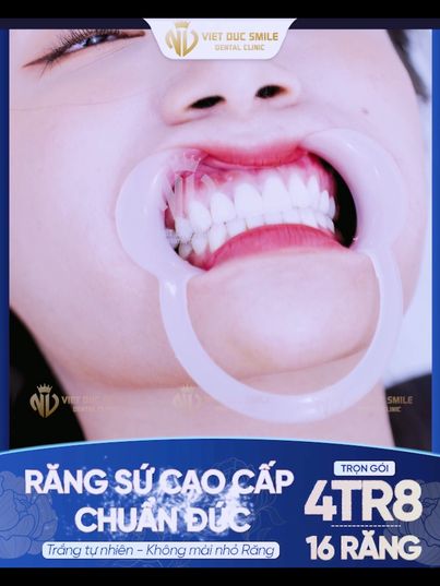 Nha Khoa Việt Đức Smile