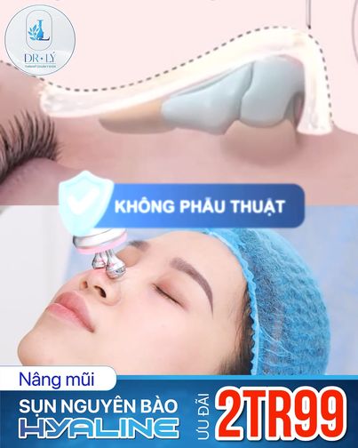 Dr Lý - Nâng Mũi Phong Thủy