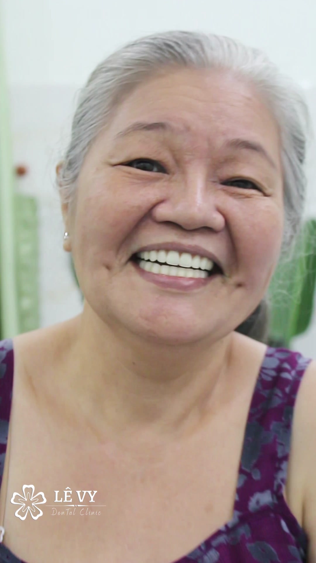 Nha Khoa Răng Tháo Lắp Lê Vy