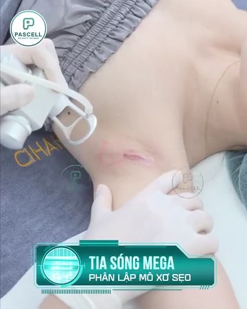 Pascell Clinic - Điều Trị Sẹo Tận Gốc Công Nghệ Cao