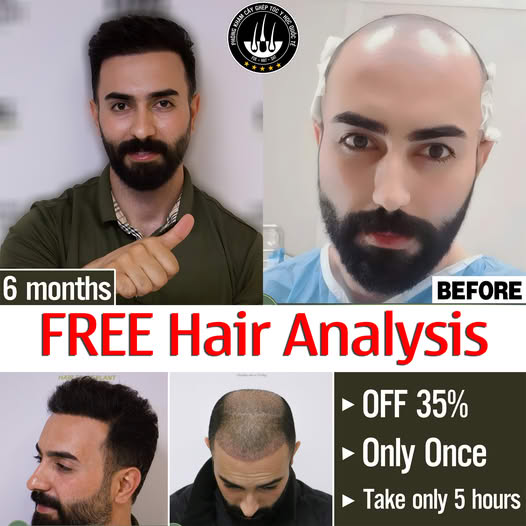 Hcm Hair Transplant Institute