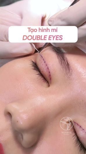 Bác sĩ Huy - Tạo Hình Mí Số 1 Sài Gòn