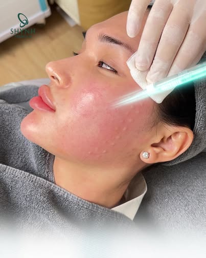Shynh Premium