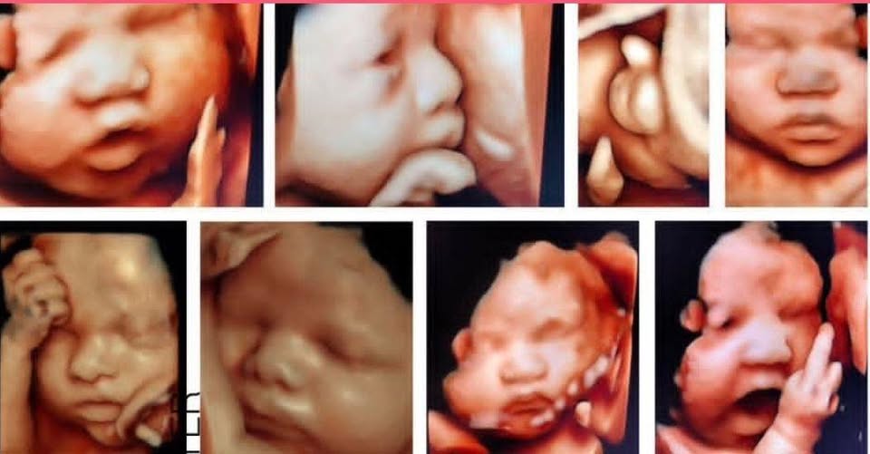 HỘI MẸ BẦU MÈO VÀNG.