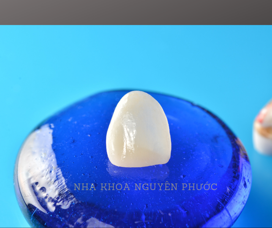 Nha Khoa Nguyên Phước