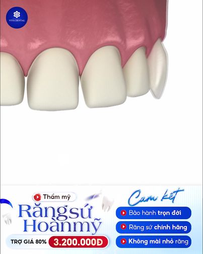 Nha Khoa Quốc Tế Viva Dental