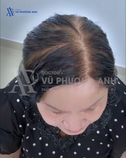 Bác Sĩ Vũ Phương Anh - Điều Trị Da Liễu Chuẩn Y Khoa 