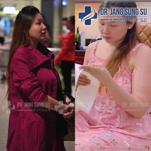 Dr. Jang Sung Su - Chuyên Khoa Thẩm Mỹ