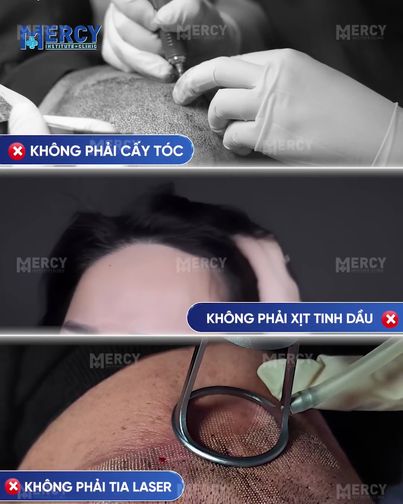 Ths. Bs Vũ Phương Anh - Chuyên khoa Nang Tóc