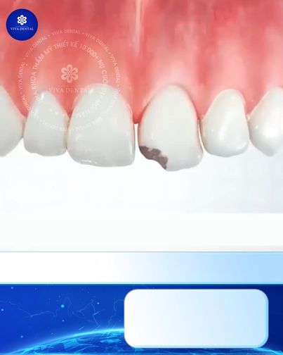 Ts-Bs Quang Huynh Trưởng Khoa Răng Hàm Mặt Hồ Chí Minh