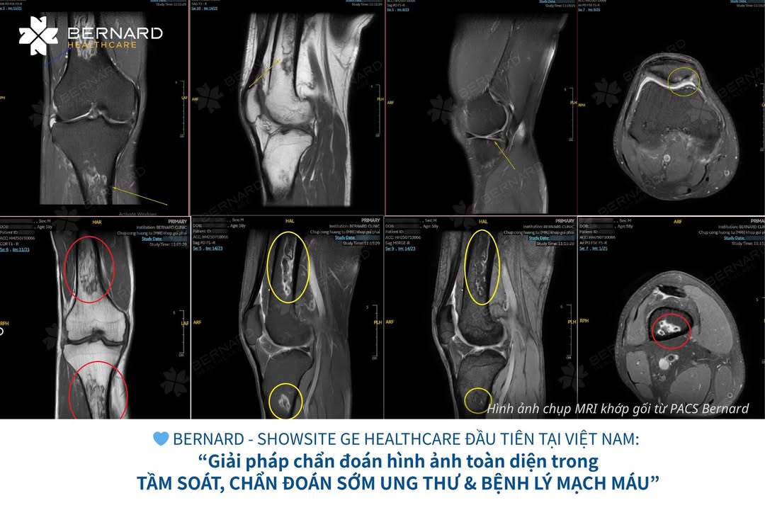 Hệ Thống Y khoa Chuyên sâu Quốc tế Bernard