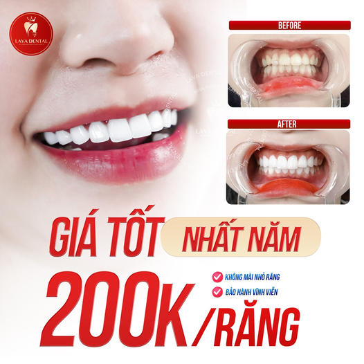 Lava Dental - Viện Răng Hàm Mặt Quốc Tế