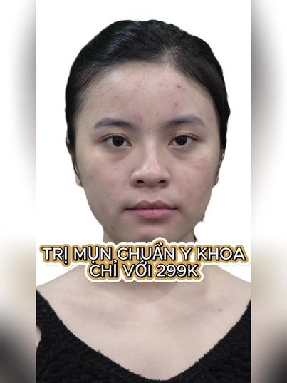 Phòng khám da Sothic Q10 - Chuyên trị Mụn, Thâm, Sẹo rỗ