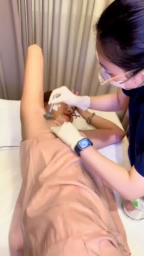 Hệ Thống Triệt Lông Lớn Nhất Sài Gòn