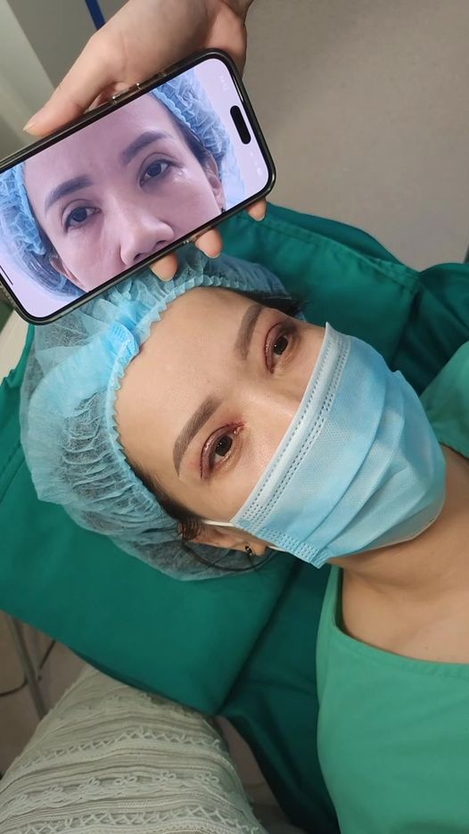 Chuyên Sửa Mí Hỏng - Trang Beauty Center