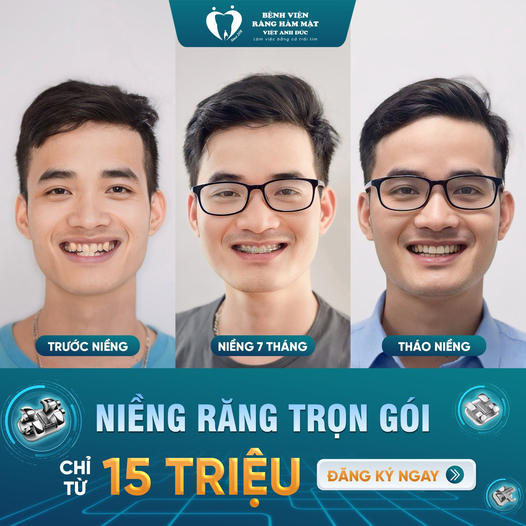 Bệnh Viện Răng Hàm Mặt Việt Anh Đức