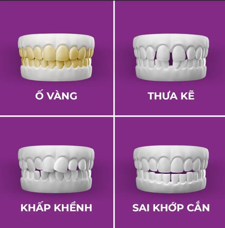 Nha Khoa Thông Minh Auris