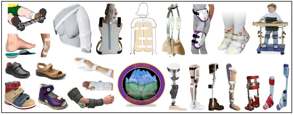 Orthotics, Prosthetics, Rehabilitation & Foot Care Services in Hyderabad