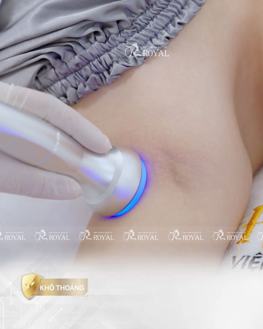 Đặc trị hôi nách vĩnh viễn - Viện da liễu Royal Sài Gòn