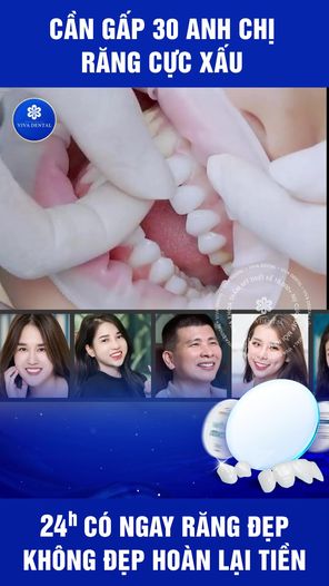 Ts-Bs Quang Huynh Trưởng Khoa Răng Hàm Mặt Hồ Chí Minh