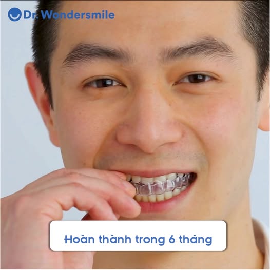 Dr. Wondersmile - Khay niềng trong suốt ban đêm
