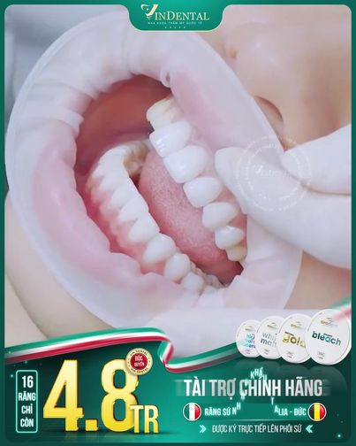 Ts Bs Khang Nguyễn - Trưởng Khoa Răng Hàm Mặt Hồ Chí Minh
