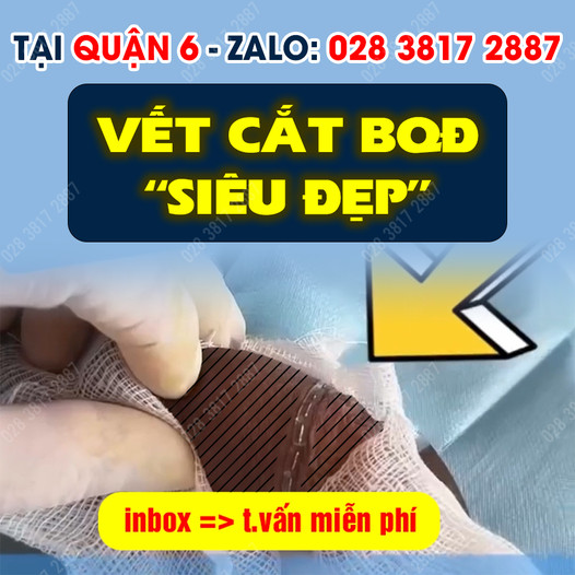 BS. Cắt Bao Q.Đầu - Quận 6