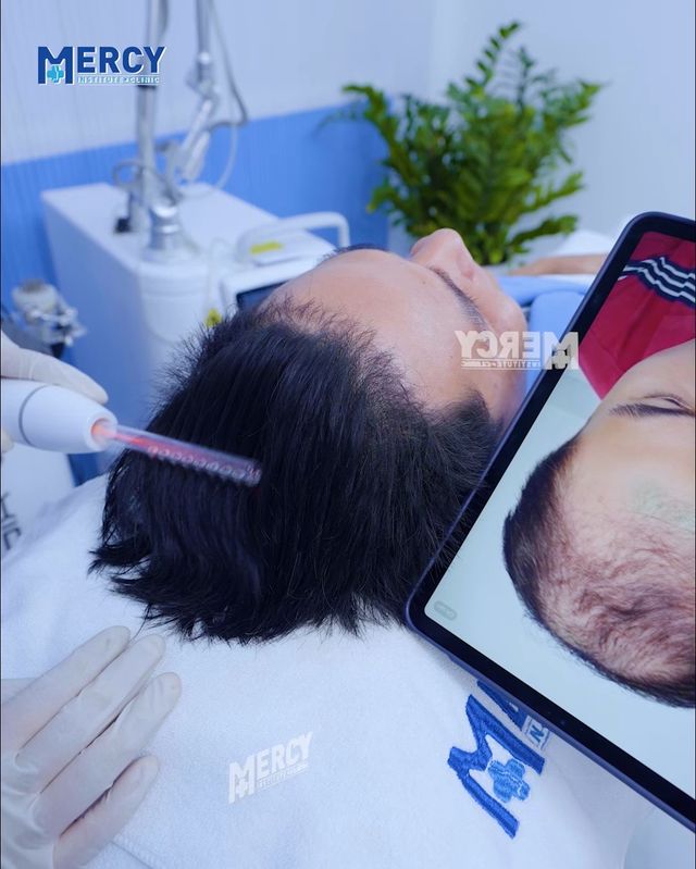 Thạc Sỹ Bác Sĩ Vũ Phương Anh - Chuyên Khoa Nang Tóc