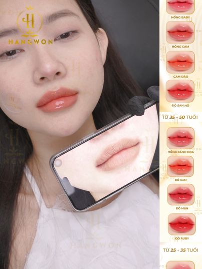 Viện Cấy Môi HangWon 