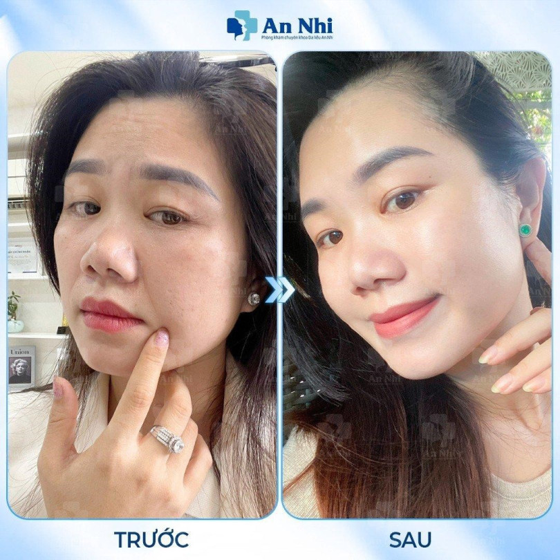 Bác sĩ Hải Hà