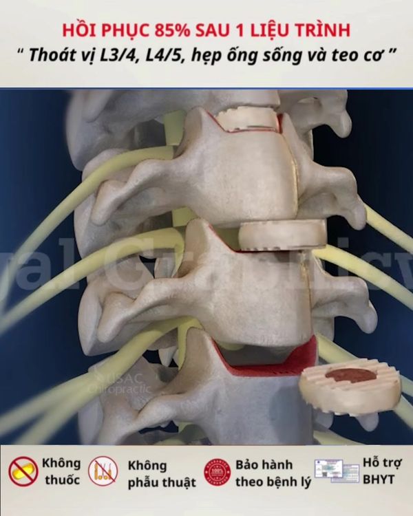 Chuyên Khoa Xương Khớp Quốc Tế Việt Đức Sài Gòn