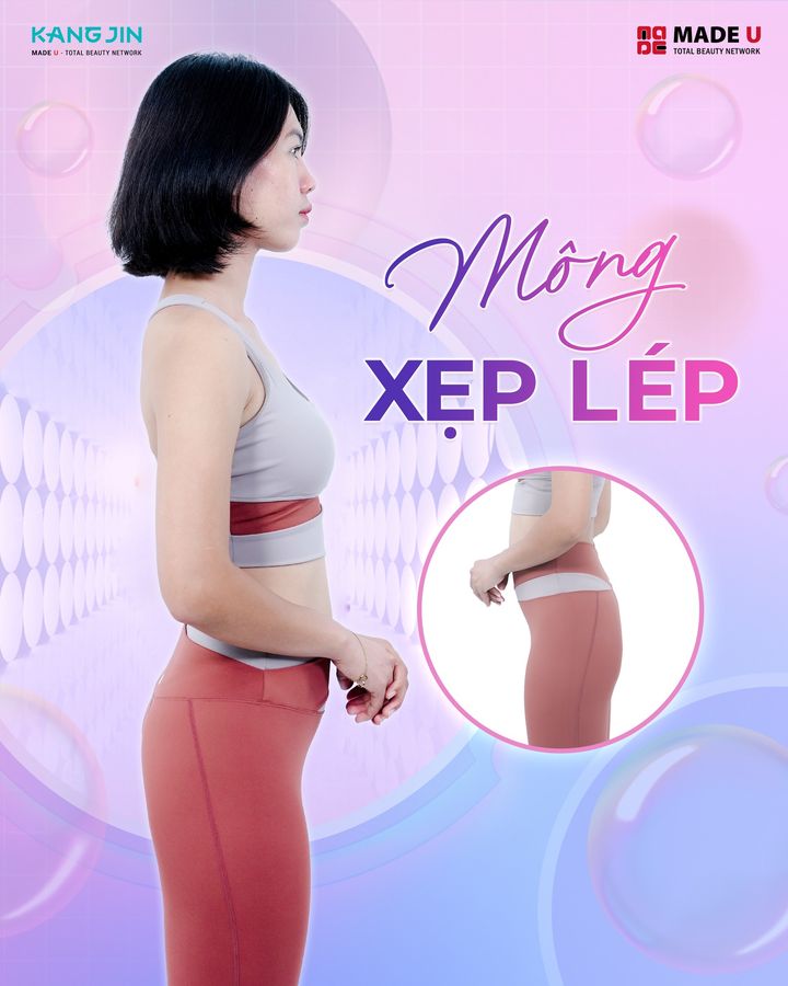 Thăng Hạng Vòng 3 - Viện Thẩm Mỹ KangJin