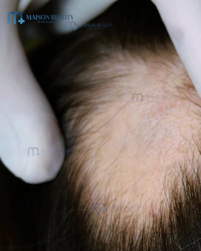 Maison Beauty - Trung Tâm Làm Đẹp CNC Hồ Chí Minh