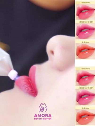 Viện Thẩm Mỹ Lanis Beauty