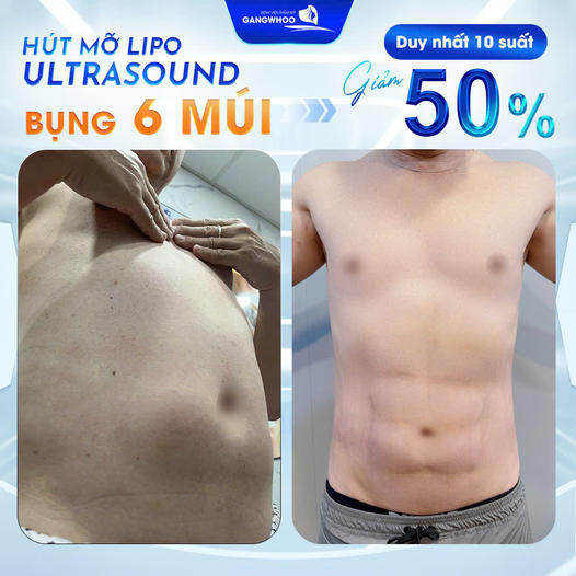 Bệnh viện thẩm mỹ Gangwhoo