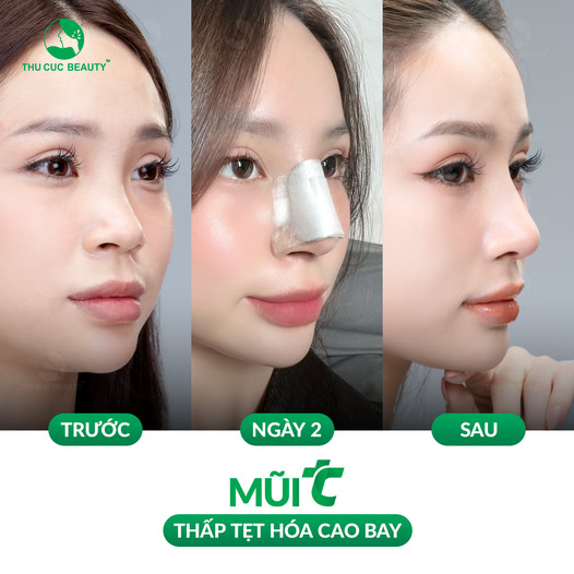 Bệnh Viện Thẩm Mỹ Thu Cúc Sài Gòn