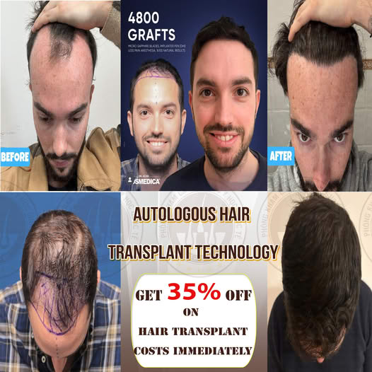 Phòng Khám Cấy Tóc Y Học Quốc Tế - Hair Transplant Clinic