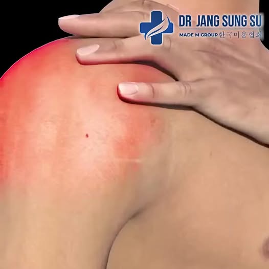 Dr. Jang Sung Su - Viện Giảm Mỡ Chuẩn Y Khoa
